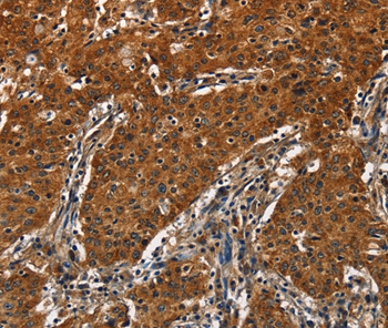 CATSPER4 Antibody