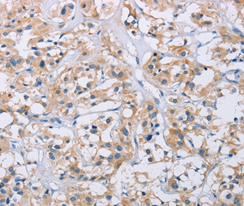 CCR9 Antibody