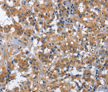 IL2RB Antibody