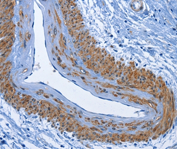 CD177 Antibody