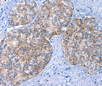 BCAM Antibody