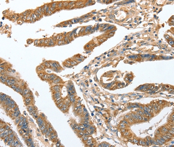 CKAP2 Antibody