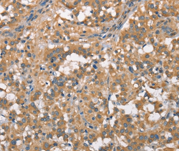 PLEKHO1 Antibody