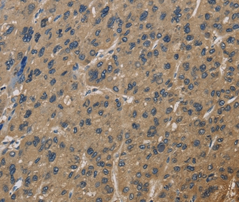 CORO1C Antibody