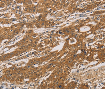 CYP17A1 Antibody