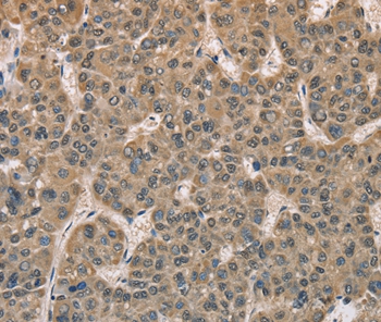 DACH2 Antibody