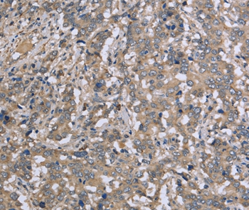 DTNB Antibody