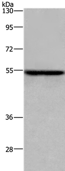 ETS2 Antibody