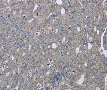 EZR Antibody