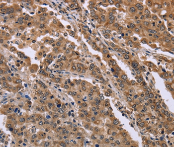 FAM3B Antibody
