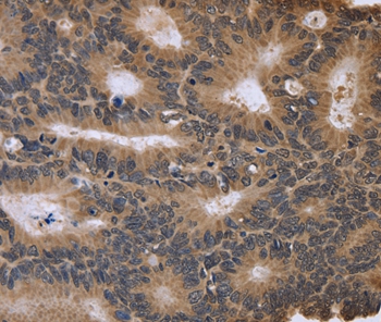 FGFR1OP2 Antibody