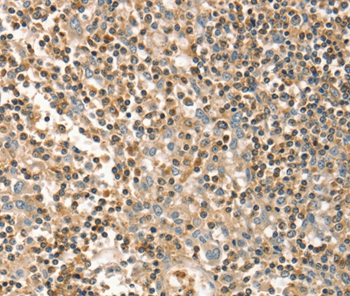 FMNL1 Antibody