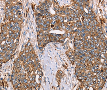 FUCA1 Antibody
