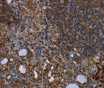 HMGCL Antibody