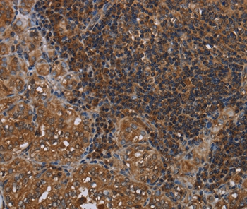 HOMER2 Antibody