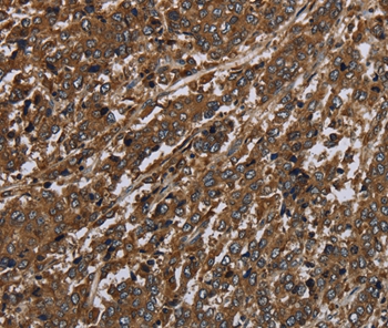 HPGD Antibody
