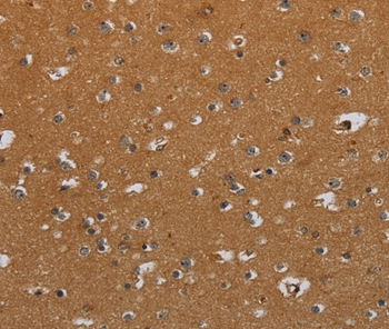 CSH1 Antibody