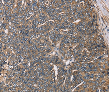 HSD17B12 Antibody