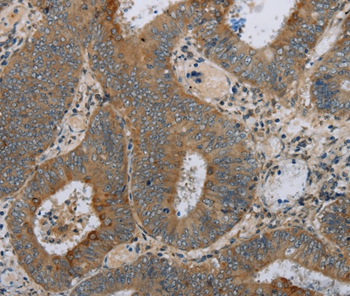 HSD17B14 Antibody