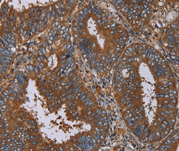 IL27RA Antibody