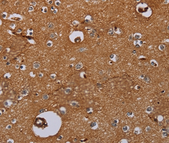 IL27RA Antibody