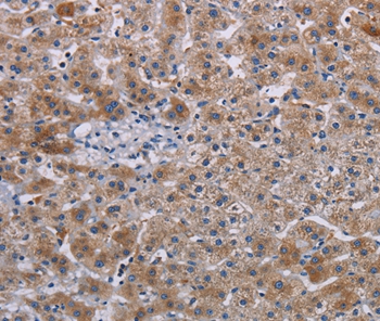 JAKMIP2 Antibody