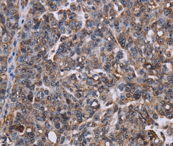 LDOC1 Antibody