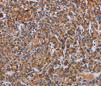 LRRC15 Antibody