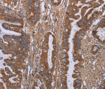 LUM Antibody