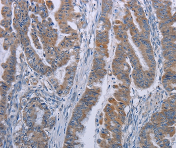 LYN Antibody