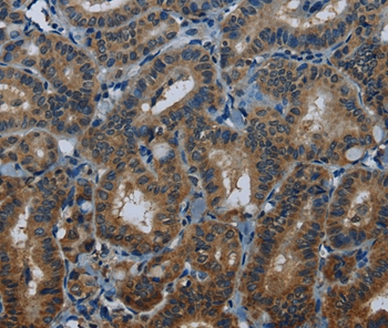 MEI1 Antibody