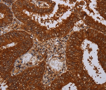 MFAP3L Antibody