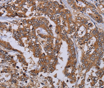 MFAP3L Antibody
