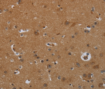 ENTPD7 Antibody