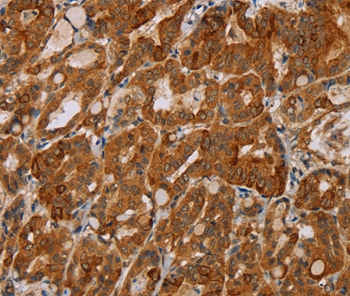 MTUS1 Antibody