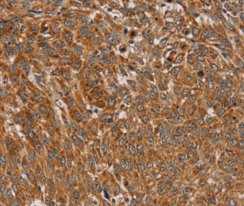 PLEKHG6 Antibody
