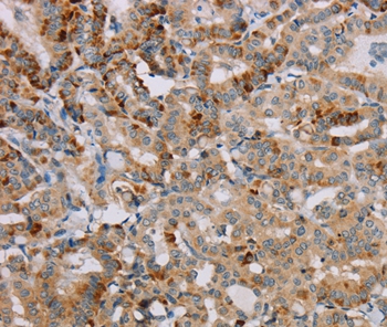 PPP1R12A Antibody