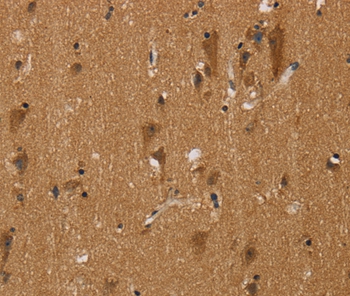 NGFRAP1 Antibody