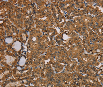 NGFRAP1 Antibody