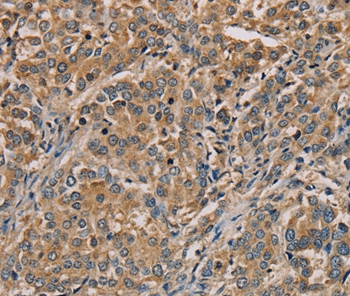 NANOS2 Antibody