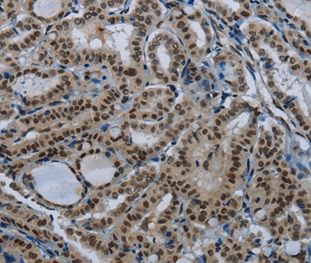 NBL1 Antibody
