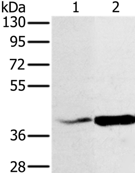 NDUFA10 Antibody