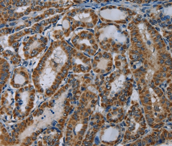 NDUFA5 Antibody