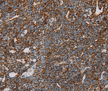 NDUFS3 Antibody