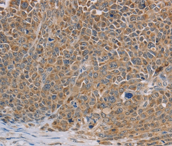 NDUFS7 Antibody