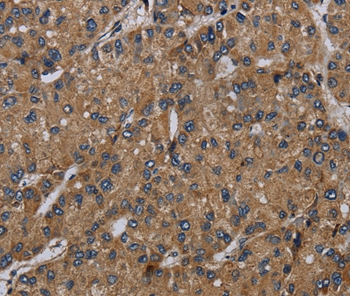 NDUFS6 Antibody