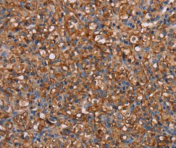 NEDD4L Antibody