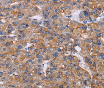 NIT1 Antibody