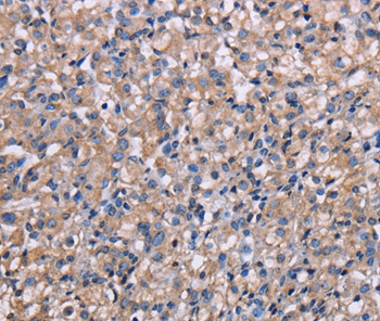 NIT1 Antibody