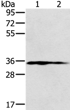 NIT1 Antibody